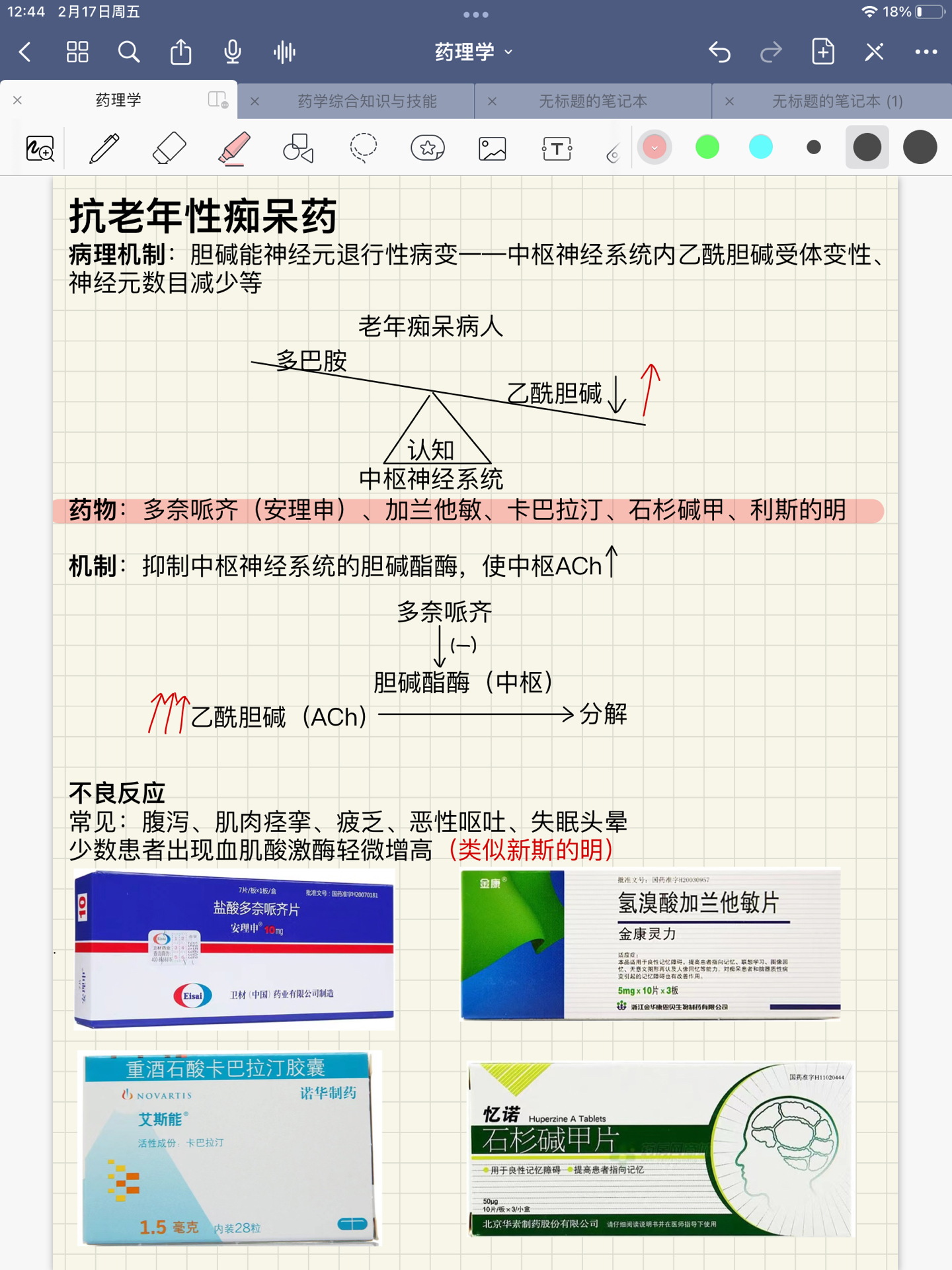 最新抗痴呆药物的研究进展与应用探索